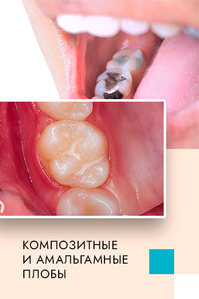 stomatologia-plombi.jpg stomatologia-plombi.jpg