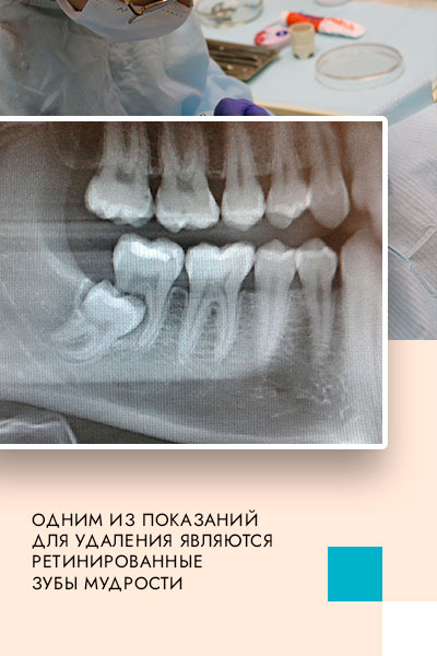 udal-zuba.jpg udal-zuba.jpg